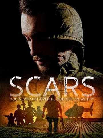 Scars
