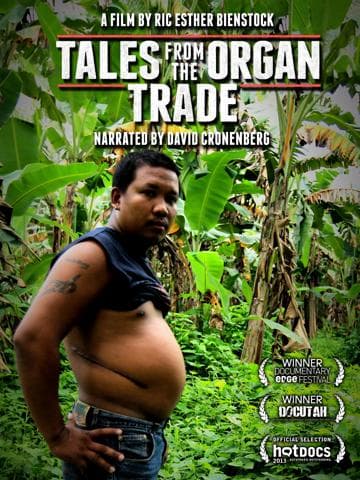 Tales from the Organ Trade
