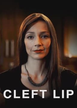Cleft Lip