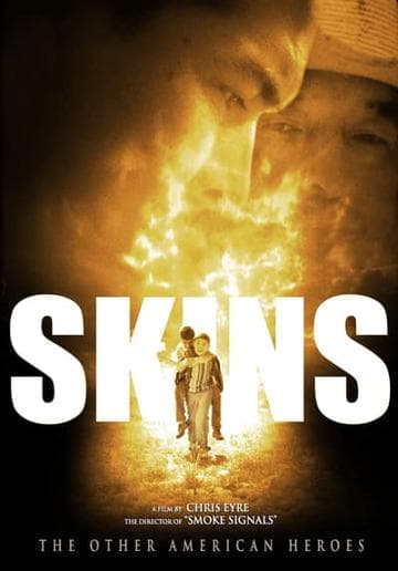 Skins