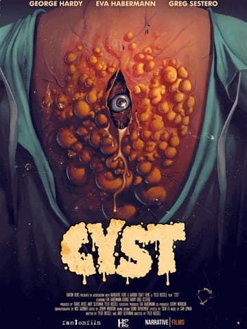 Cyst